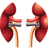 Implantable kidney